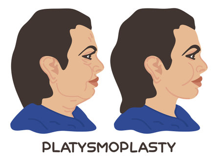 Plastysmoplasty. Before and after.のイラスト素材
