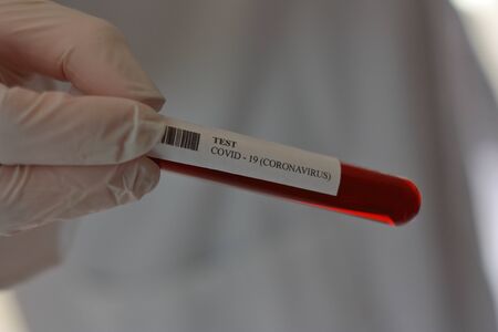 TEST CORONAVIRUS (COVID -19)の写真素材