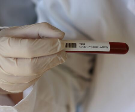 TEST CORONAVIRUS (COVID -19)