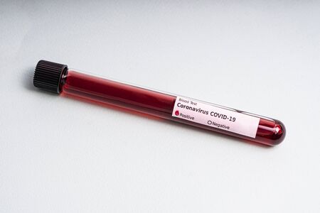 Hand holds a test tube containing a blood sample, test tube  for Covid-19 (coronavirus) analyzing....