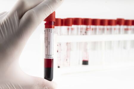 Hand holds a test tube containing a blood sample, test tube  for Covid-19 (coronavirus) analyzing. Laboratory testing patientâs sampleの写真素材