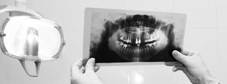 Close up female dentist hands olding X-ray image in dental office.の写真素材