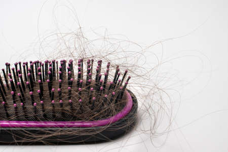 Hair loss on a comb on a white background. Baldness.の写真素材