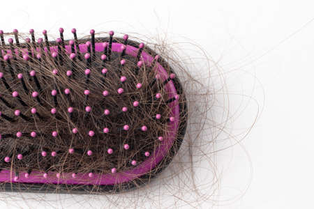 Hair loss on a comb on a white background. Baldness.の写真素材