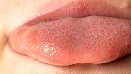 Macro photo of healthy human language. Tongue papillae taste buds and taste. Close up.の写真素材