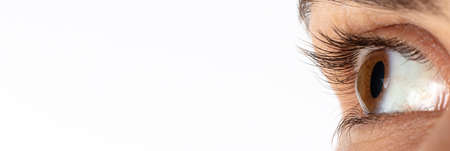 Macro eye photo. Keratoconus - eye disease, thinning of the cornea in the form of a cone. The cornea...