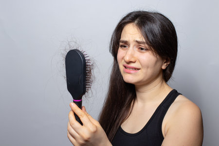 The girl holds a comb for hair with fallen hair. Hair loss, hair care.の写真素材