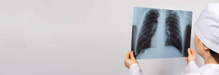A doctor examines an X-ray of the lungs of a patient with pneumonia. Pulmonology and radiology, lung...