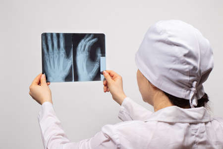 A doctor or radiologist holds an X-ray of a patient with a hand injury. Diagnosis of fractures,...