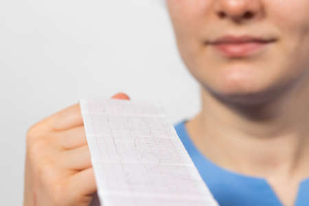 The cardiologist shows the film of an electrocardiogram of a patient with acute myocardial infarction. Heart and cardiovascular disease, cardiology and cardiography.の写真素材