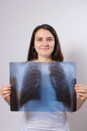 The woman holds an X-ray image of her lungs at chest levelの写真素材