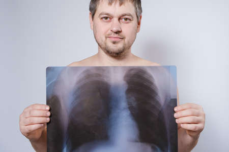 A man holds an X-ray image of her lungs at chest levelの写真素材