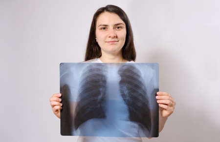The woman holds an X-ray image of her lungs at chest levelの写真素材