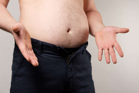 A man in small pants spreads his arms to the sides. The concept of male obesity.の写真素材