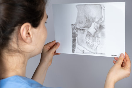 The doctor holds a CT scan of a patient with temporomandibular joint dysfunction and malocclusion.の写真素材