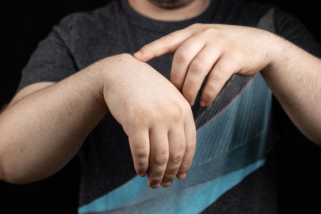 A male patient shows a ganglion cyst on his wrist.の写真素材