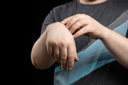 Ganglion cyst or hygroma of the wrist on the hand of a male patientの写真素材