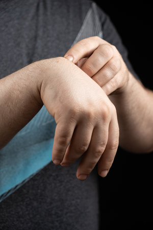 A male patient shows a ganglion cyst on his wrist.の写真素材