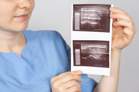 The doctor holds the results of an ultrasound of the thyroid gland of a patient with small nodules in the thyroid gland.の写真素材