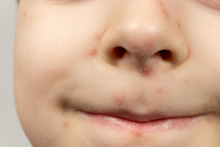 Skin of a child with symptoms of chickenpox, skin rashの写真素材