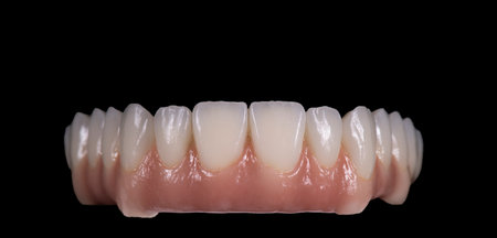 ceramic bridge for all on 8 inplants