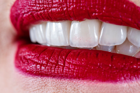 emax ceramic crowns and veneersの写真素材