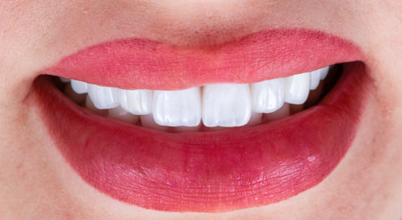 emax ceramic crowns and veneersの写真素材