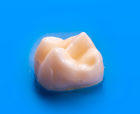 teeth direct fillingの写真素材