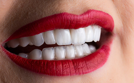 emax ceramic crowns and veneersの写真素材