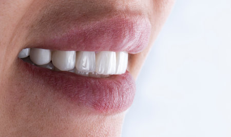 emax ceramic crowns and veneersの写真素材