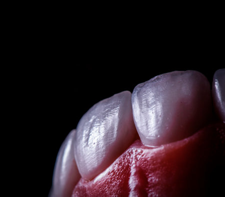 emax crowns and veneersの写真素材