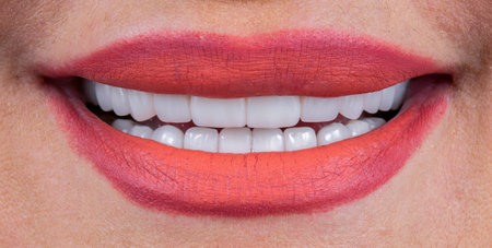 emax crowns and veneersの写真素材