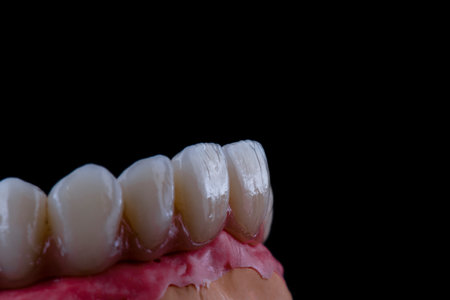 restorations on dental implants