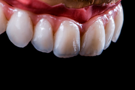 restorations on dental implantsの写真素材