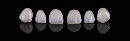 emax crowns and veneers bl2 colorの写真素材