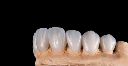 emax crowns and veneers bl2 colorの写真素材