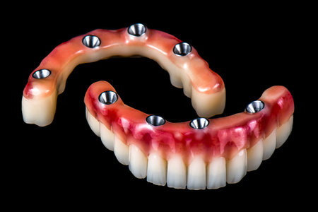 dental photography of full arch zircon bridge on implants