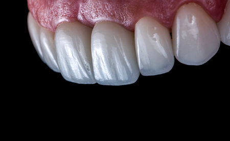 dental treatment picturesの写真素材