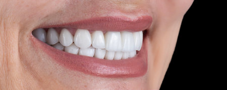 dental treatment picturesの写真素材