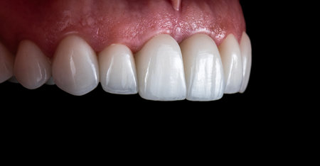 dental treatment picturesの写真素材