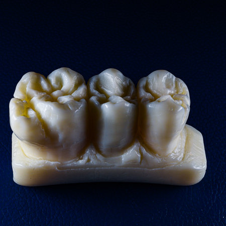carved tooth on soap by dental assistant