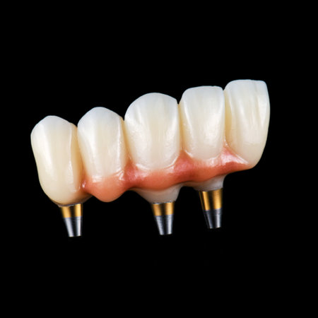 emax ceramic cowens on implantsの写真素材