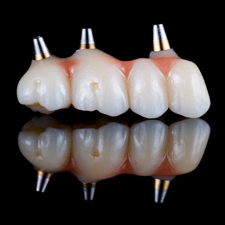 emax ceramic cowens on implantsの写真素材