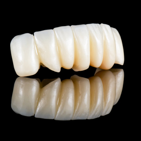 emax ceramic cowens on implantsの写真素材