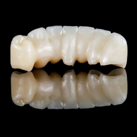 emax ceramic cowens on implantsの写真素材