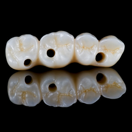 emax ceramic cowens on implantsの写真素材
