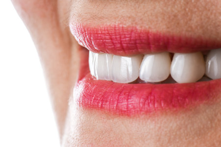 ceramic crowns and veneersの写真素材