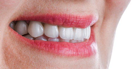 ceramic crowns and veneersの写真素材