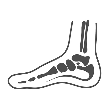 Medial Foot Anatomy Isolated On A White Background. Vector Illustration. Orthopedics, Organs Concept.のイラスト素材