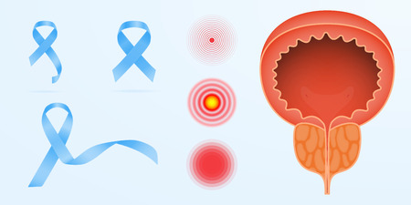 Prostate cancer color icon. Men s reproductive system disease. Male infertility and genital problem. Groin pain. Isolated vector illustrationのイラスト素材
